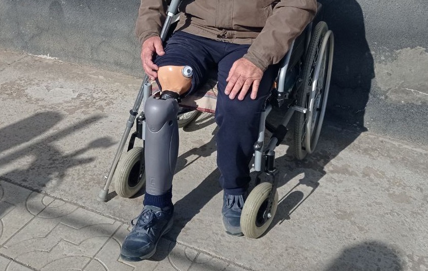 ФСС обеспечил пострадавшего на производстве из Республики Калмыкия современным дорогостоящим протезом бедра