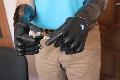 Фонд социального страхования обеспечил инвалида высокотехнологичными протезами предплечья с микропроцессорным управлением