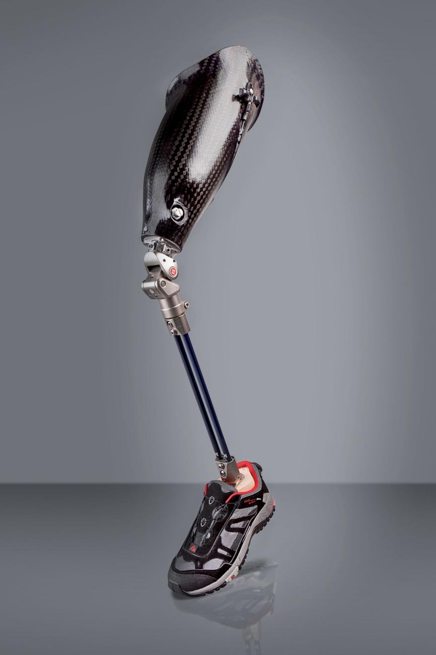 Фонд обеспечил инвалида Ульяновской области современным высокотехнологичным протезом