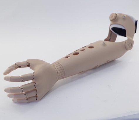 Фонд социального страхования в Курске выдал инвалиду высокотехнологичный протез предплечья с микропроцессорным управлением