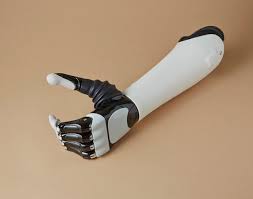 В Иркутске Фонд  обеспечил инвалида функциональным протезом предплечья с микропроцессорным управлением