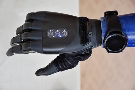 В Тверской области Фонд обеспечил пострадавшего на производстве высокотехнологичным протезом кисти